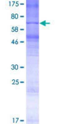12.5% SDS-PAGE Stained with Coomassie Blue.