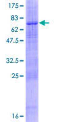 12.5% SDS-PAGE Stained with Coomassie Blue.