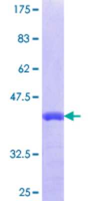 12.5% SDS-PAGE Stained with Coomassie Blue.