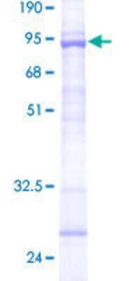12.5% SDS-PAGE Stained with Coomassie Blue.