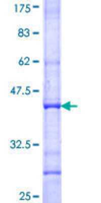 12.5% SDS-PAGE Stained with Coomassie Blue.