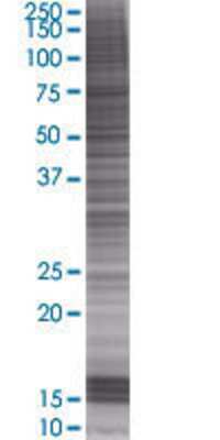 UBR3 transfected lysate.