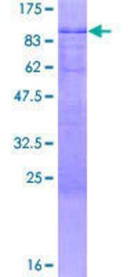 12.5% SDS-PAGE Stained with Coomassie Blue.