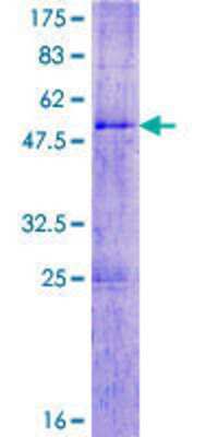 12.5% SDS-PAGE Stained with Coomassie Blue.