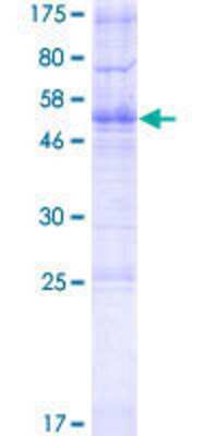 12.5% SDS-PAGE Stained with Coomassie Blue.