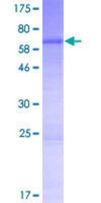 12.5% SDS-PAGE Stained with Coomassie Blue.