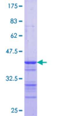12.5% SDS-PAGE Stained with Coomassie Blue.