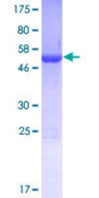 SDS-Page: Recombinant Human PDCL2 Protein [H00132954-P01] - 12.5% SDS-PAGE Stained with Coomassie Blue.