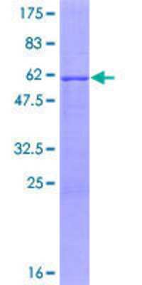 12.5% SDS-PAGE Stained with Coomassie Blue.