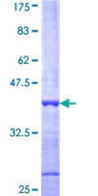12.5% SDS-PAGE Stained with Coomassie Blue.