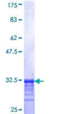 12.5% SDS-PAGE Stained with Coomassie Blue.