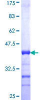 12.5% SDS-PAGE Stained with Coomassie Blue.