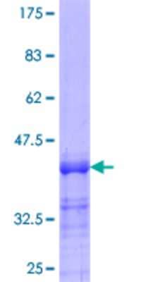 12.5% SDS-PAGE Stained with Coomassie Blue.