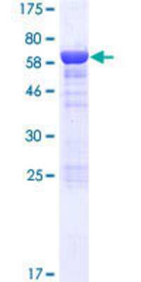 SDS-PAGE Recombinant Human ASZ1 GST (N-Term) Protein