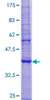 Recombinant Human TMEM68 Protein [H00137695-P01] - 12.5% SDS-PAGE Stained with Coomassie Blue.