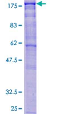 12.5% SDS-PAGE Stained with Coomassie Blue.
