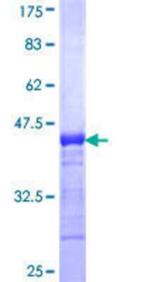 12.5% SDS-PAGE Stained with Coomassie Blue.