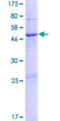 Other Recombinant Human PTCHD1 GST (N-Term) Protein