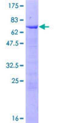 12.5% SDS-PAGE Stained with Coomassie Blue.
