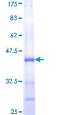 12.5% SDS-PAGE Stained with Coomassie Blue.