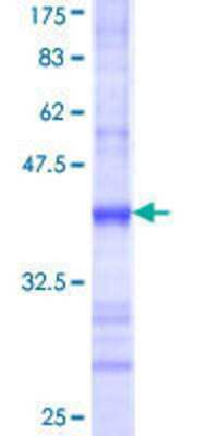 12.5% SDS-PAGE Stained with Coomassie Blue.