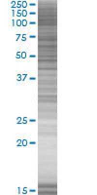 ZNF358 transfected lysate.
