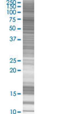 SUHW2 transfected lysate.