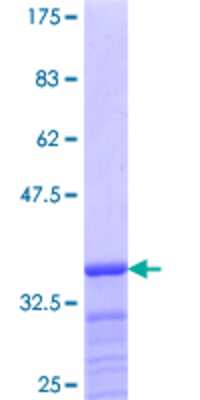 12.5% SDS-PAGE Stained with Coomassie Blue.