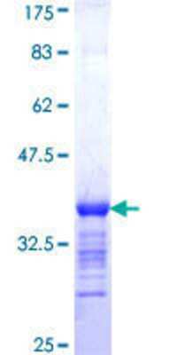 PRICKLE1 Research Products: Novus Biologicals