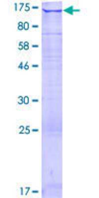 12.5% SDS-PAGE Stained with Coomassie Blue.
