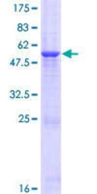 12.5% SDS-PAGE Stained with Coomassie Blue.