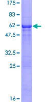 Other Recombinant Human RAD9B GST (N-Term) Protein