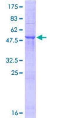 12.5% SDS-PAGE Stained with Coomassie Blue.