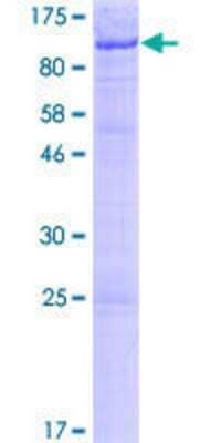 12.5% SDS-PAGE Stained with Coomassie Blue.