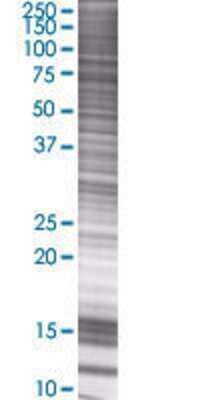 EME1 transfected lysate.