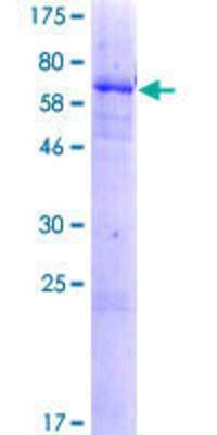 Other Recombinant Human DHRS13 GST (N-Term) Protein