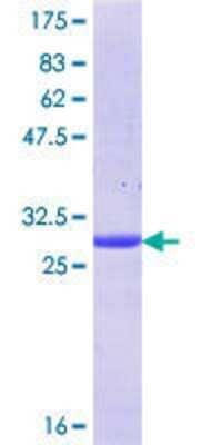 12.5% SDS-PAGE Stained with Coomassie Blue.