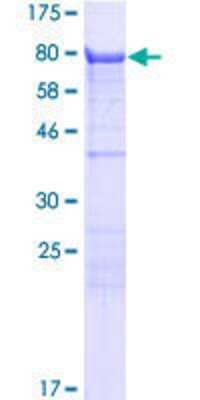 12.5% SDS-PAGE Stained with Coomassie Blue.