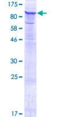 12.5% SDS-PAGE Stained with Coomassie Blue.