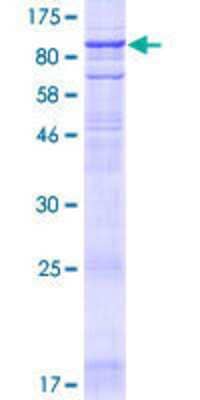 12.5% SDS-PAGE Stained with Coomassie Blue.