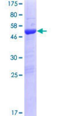 Other Recombinant Human TTC9B GST (N-Term) Protein