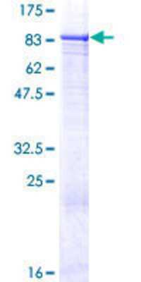 12.5% SDS-PAGE Stained with Coomassie Blue.