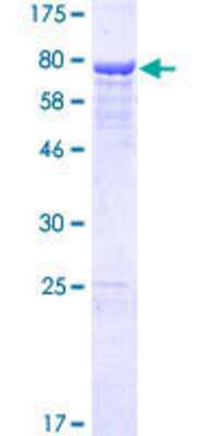 12.5% SDS-PAGE Stained with Coomassie Blue.