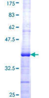 12.5% SDS-PAGE Stained with Coomassie Blue.