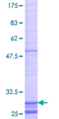 12.5% SDS-PAGE Stained with Coomassie Blue.
