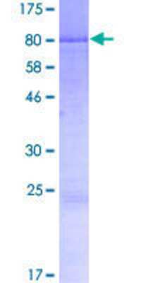 12.5% SDS-PAGE Stained with Coomassie Blue.