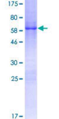 12.5% SDS-PAGE Stained with Coomassie Blue.