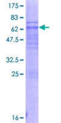 12.5% SDS-PAGE Stained with Coomassie Blue.