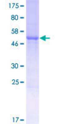 12.5% SDS-PAGE Stained with Coomassie Blue.