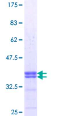 12.5% SDS-PAGE Stained with Coomassie Blue.
